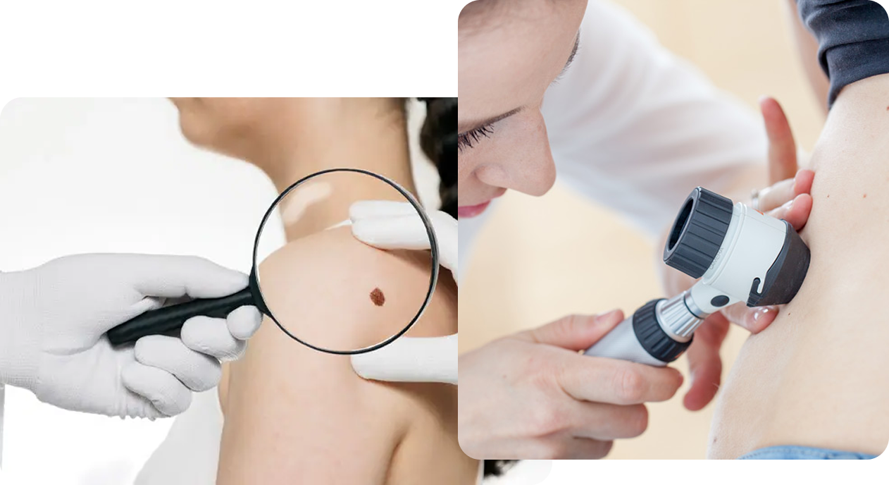 Skin & Minor Procedures